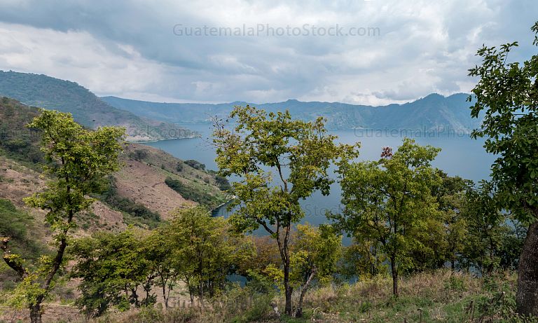Paisaje de la Laguna de Ayarza