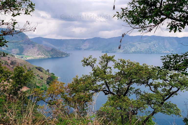 Paisaje de la Laguna de Ayarza